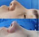 Slider image (10) Dr. Juan Sanabria Plastic Surgeon